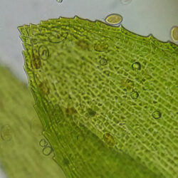 73761_bresser-microscope-erudit-basic-40-400x_17 Fragment liścia mchu pod mikroskopem z podziałką 100 µm.